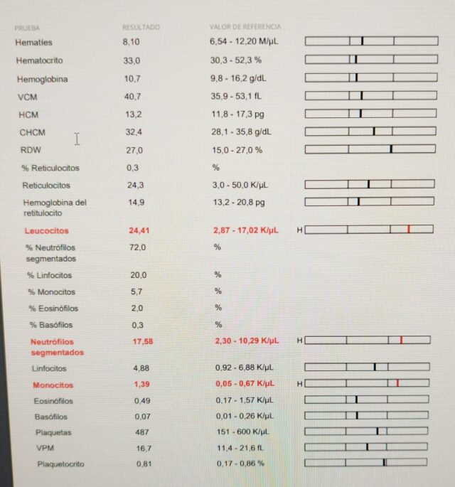 Our patient’s blood count showing leukocytosis with neutrophilia and monocytosis