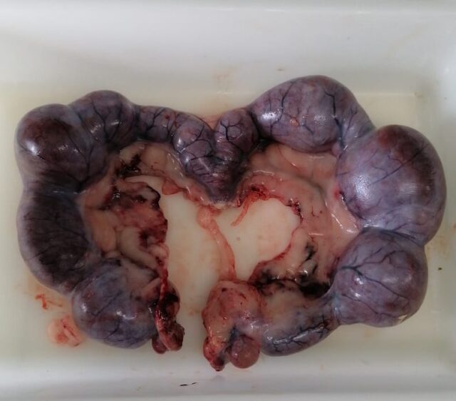Ovarios, cuernos de Falopio y útero extraídos de una paciente del hospital diagnosticada de piometra.