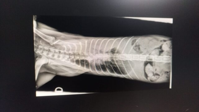VD thoracic radiography